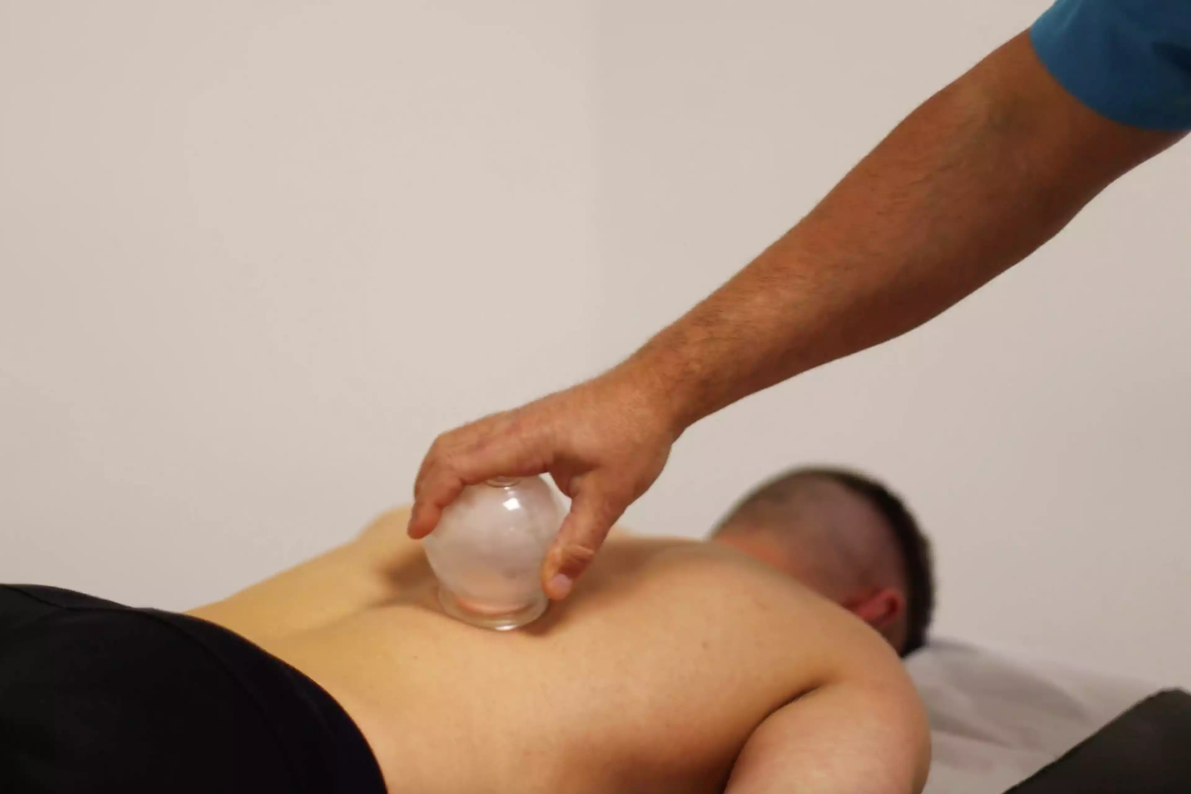 Cupping